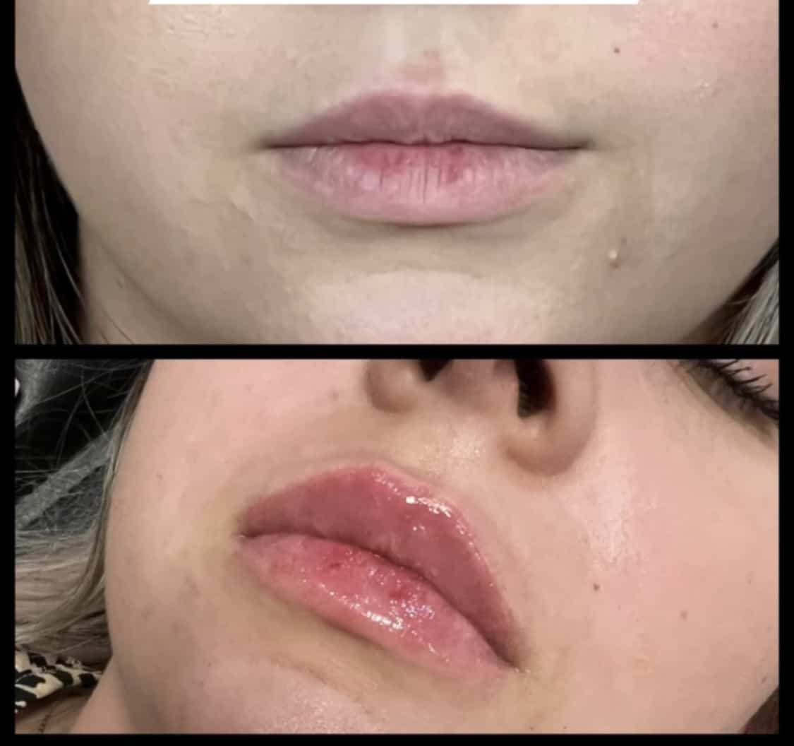 Before and After Photos Parlour at the Village in Salado