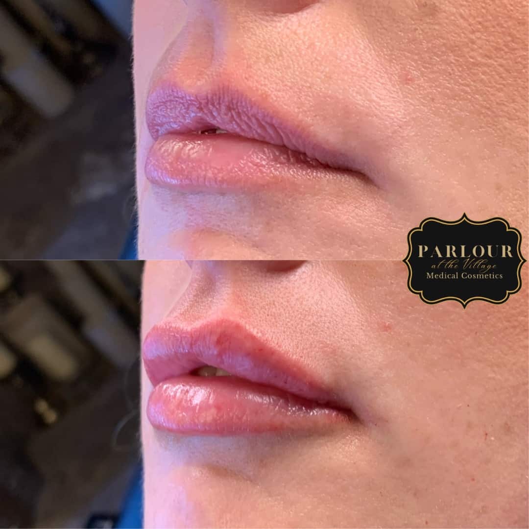 Before and After Photos Parlour at the Village in Salado