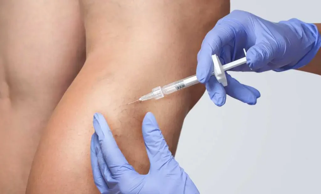 How Sclerotherapy Treats Varicose and Spider Veins 9 Sclerotherapy in Salado, TX by Parlour at the Village