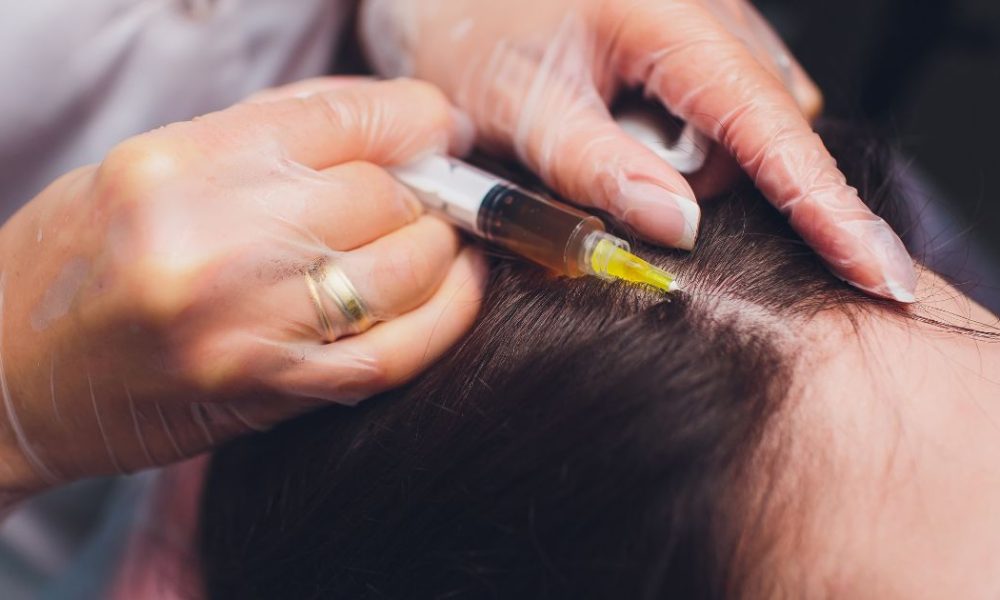 Medical professional injecting PRF (Platelet Rich Fibrin) into the scalp for hair restoration therapy.
